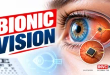 Can a Bionic Eye Restore Sight? What the Science Shows—and What Remains Unverified in India Bionic Eye: Understanding Artificial Vision